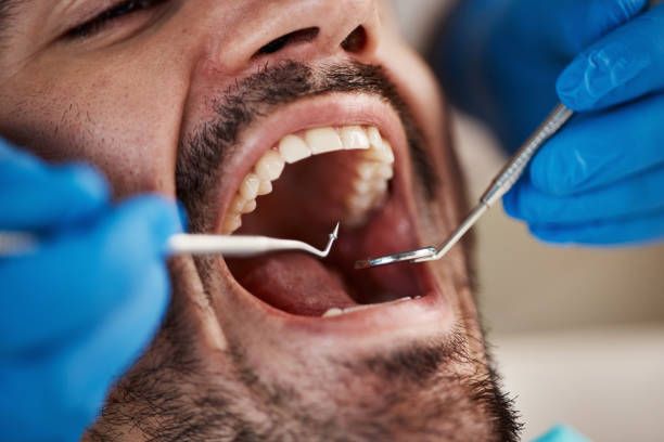 Best Tooth Extraction  in Mount Carmel, OH